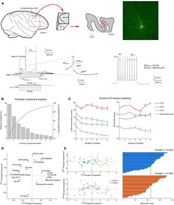 Intracellular Properties of Deep-Layer Pyramidal Neurons in Frontal Eye Field of Macaque Monkeys